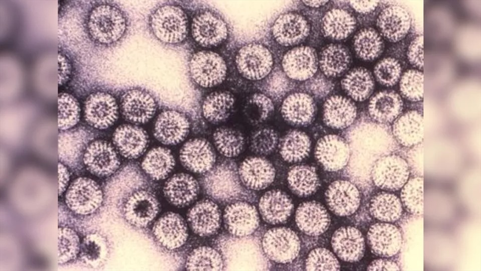 Ảnh hiển vi virus rota. Ảnh: CDC/Tiến sĩ Erskine L. Palmer