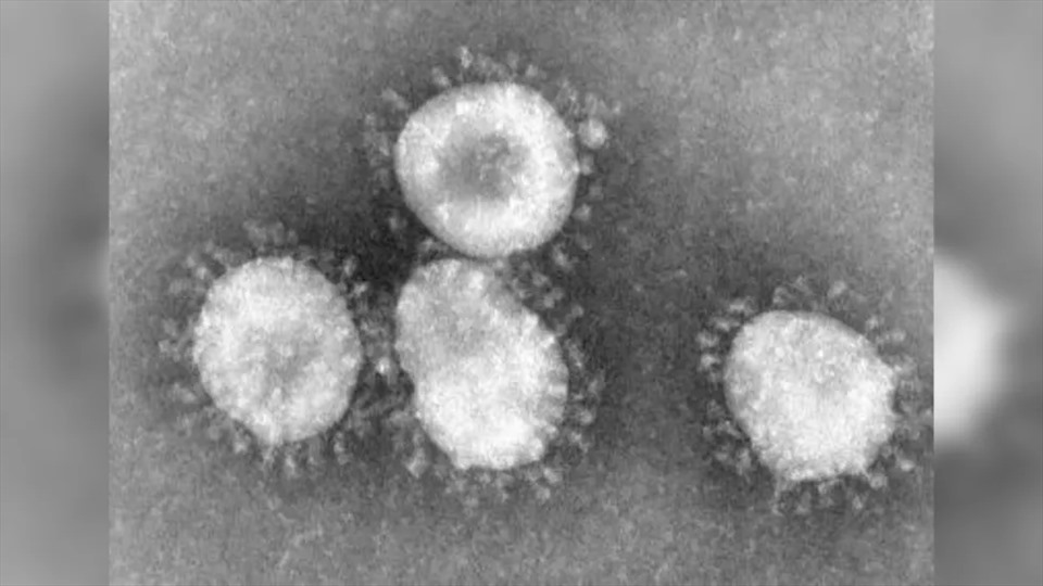 Virus SARS-CoV. Ảnh: CDC/Tiến sĩ Fred Murphy