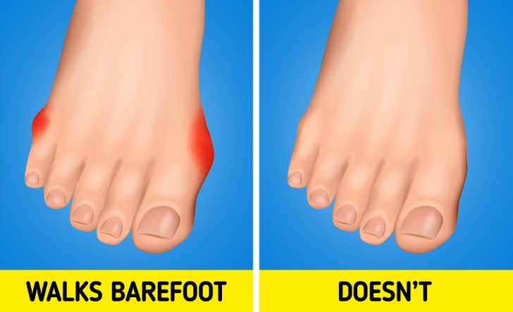 Bề mặt cứng không tốt cho bàn chân của bạn. Với những bề mặt mềm hơn cho phép bàn chân của bạn chìm xuống tự nhiên và nâng đỡ bên trong bàn chân của bạn, đôi khi giúp bạn thoải mái và giải tỏa căng thẳng. Nhưng hầu hết các sàn nhà đều quá cứng và việc đi bộ mà không có sự hỗ trợ của giày dép sẽ gây ra căng thẳng không tự nhiên, cuối cùng có thể dẫn đến đau gót chân và đầu gối của bạn.