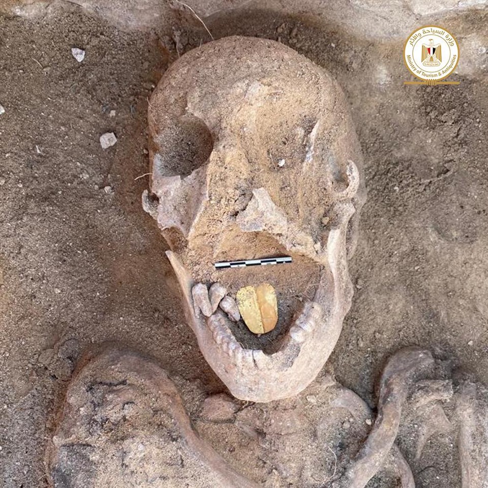 Xác ướp 2.000 năm tuổi có lưỡi vàng. Ảnh: Bộ Cổ vật Ai Cập