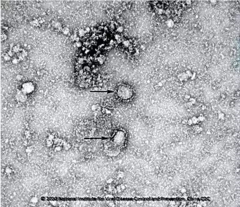 Hình ảnh của virus corona chủng mới qua kính hiển vi. Ảnh: Xinhua