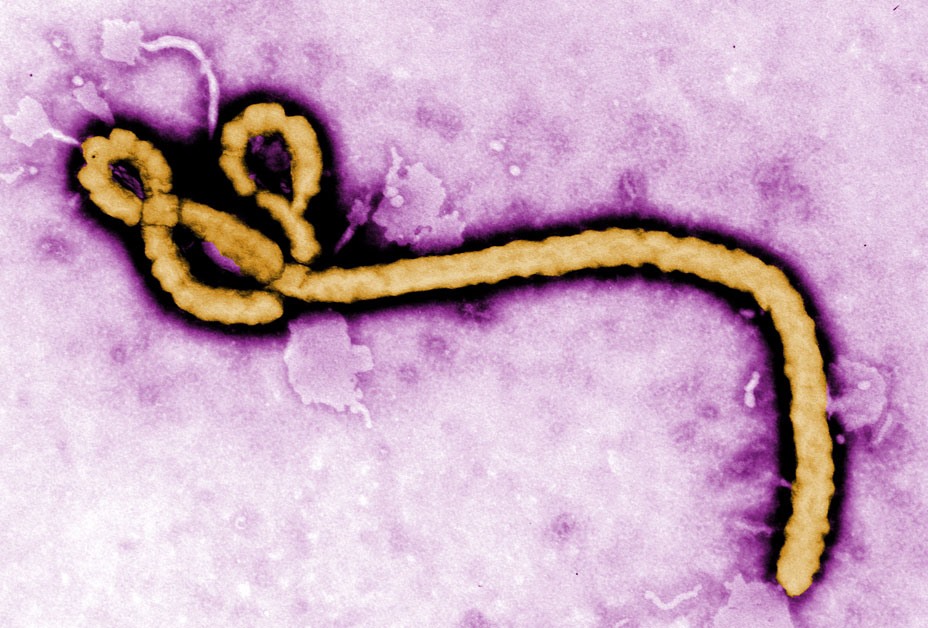 Virus Ebola dưới kính hiển vi. Ảnh: CDC