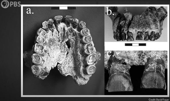 Hàm răng của tổ tiên 1,8 triệu năm tuổi có những vết xước giống như những người khác. Ảnh chụp màn hình PBS