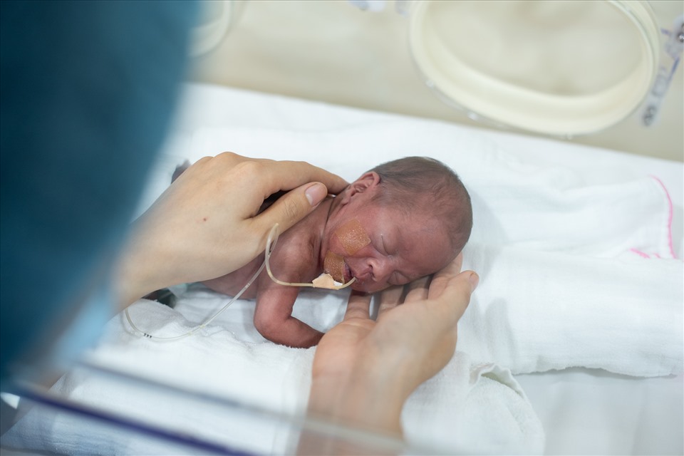 Trẻ sinh non được chăm sóc đặc biệt tại Bệnh viện Tâm Anh giúp hạn chế tối đa nguy cơ mắc các bệnh liên quan đến hệ thần kinh, não bộ… cho trẻ cơ hội sống khỏe mạnh và phát triển bình thường.