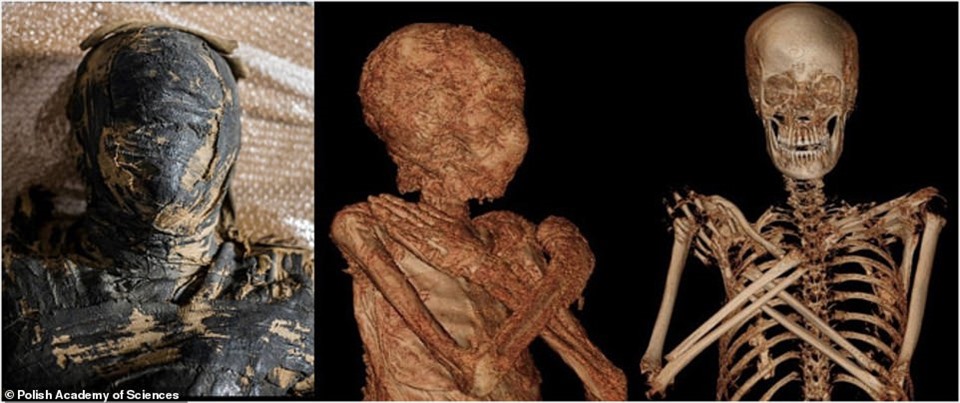 Phần đầu và chụp CT xác ướp Ai Cập cổ đại.