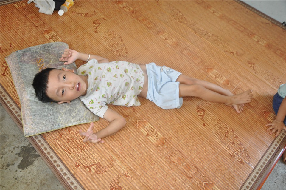Lên 6 tuổi nhưng Thành vẫn chỉ như 1 đứa trẻ vài tháng tuổi bởi căn bệnh bại não thể co cứng.