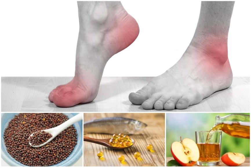 Thực phẩm hỗ trợ trị đau chân tại nhà