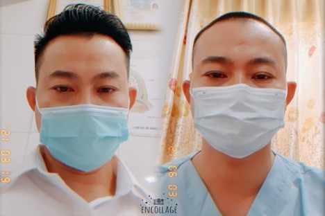 Bác sĩ Chung trước và sau khi “xuống tóc“. Ảnh SKĐS