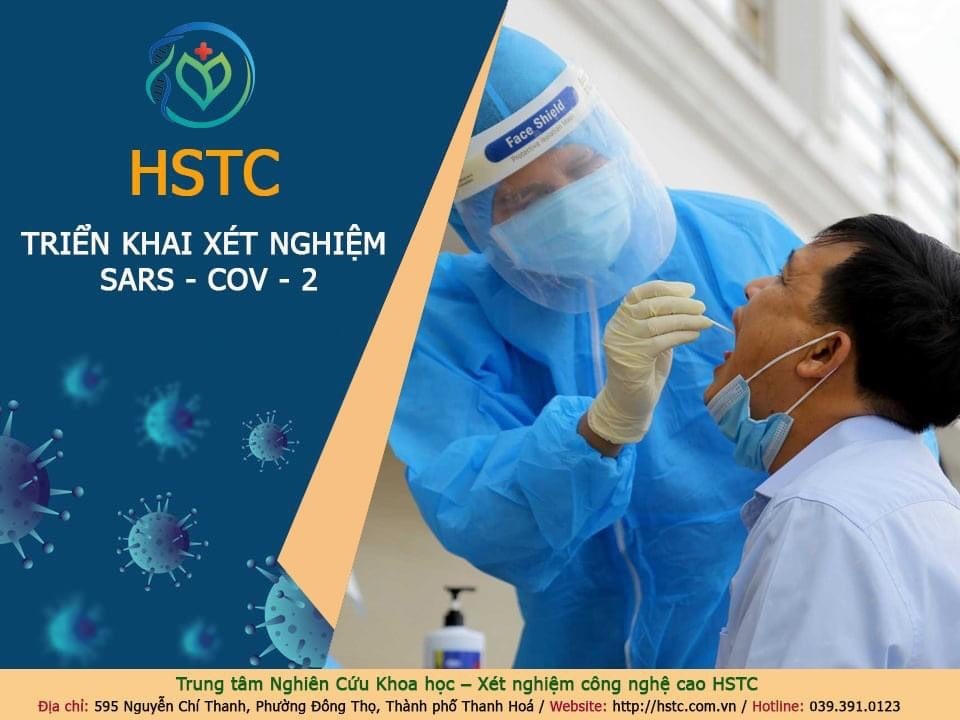 HSTC triển khai xét nghiệm COVID-19. Ảnh: Nguyễn Linh