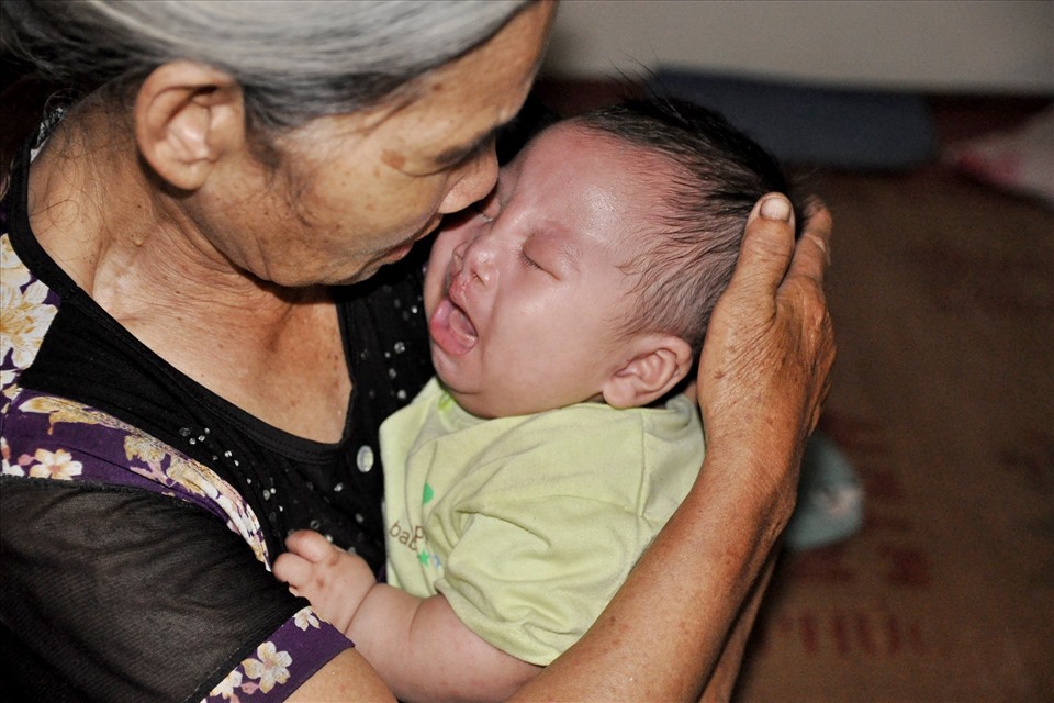 4 tháng tuổi, Minh Khôi bị tật sứt môi hở hàm ếch và tim bẩm sinh nặng.