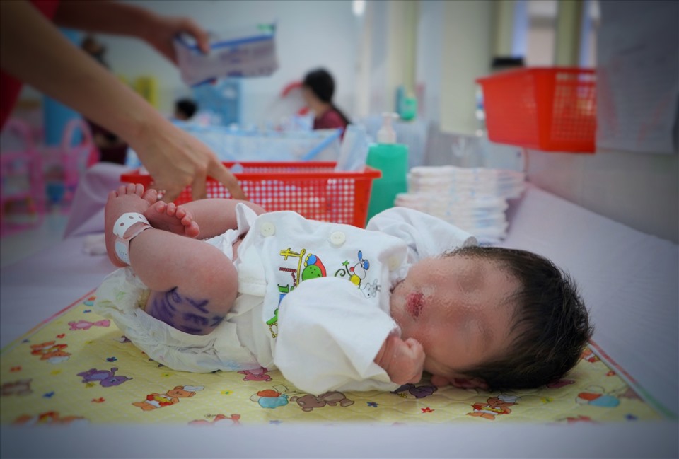 Các em bé hầu hết đều chưa được đặt tên, chân vẫn còn đeo thẻ nhận diện được bệnh viện gắn từ lúc mới sinh với thông tin của mẹ.