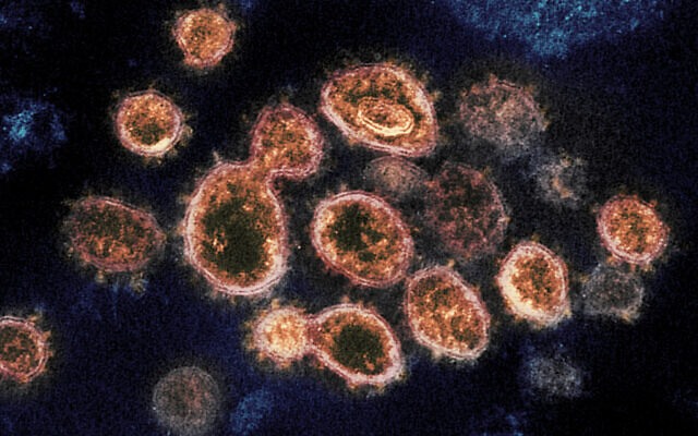 Virus SARS-CoV-2. Ảnh: NIAID-RML