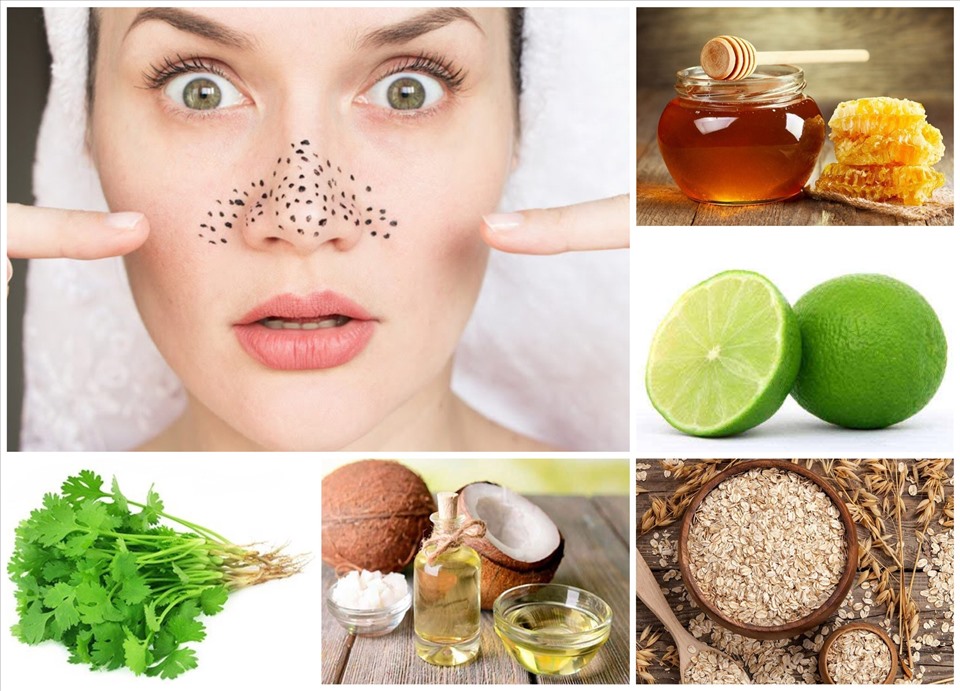 10 cách làm sạch da mặt bị mụn đơn giản ngay tại nhà