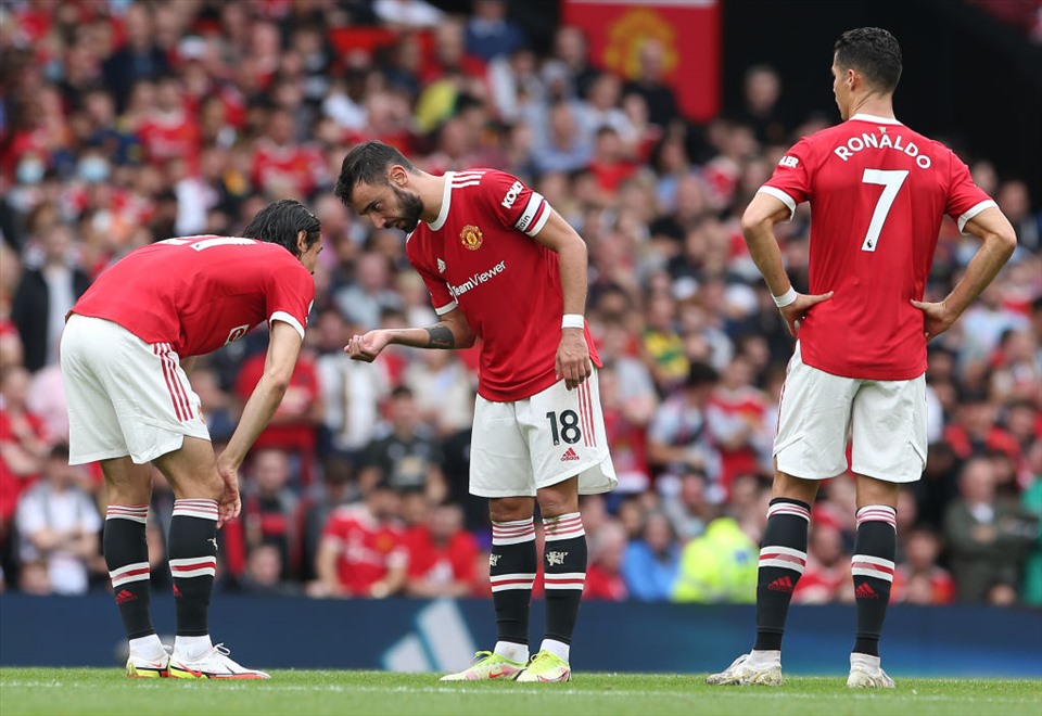 Man United vẫn có đội hình mạnh nhất đối đầu
