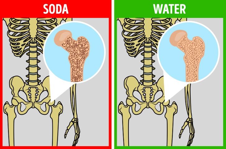 Soda không được coi là tốt cho sức khỏe vì sự không đường, không calo. Nhưng hàm lượng phốt phát trong các loại soda này sẽ làm mất sự cân bằng khoáng chất trong xương. Hãy uống nước lọc, sẽ là lựa chọn tốt hơn cho xương so với soda.