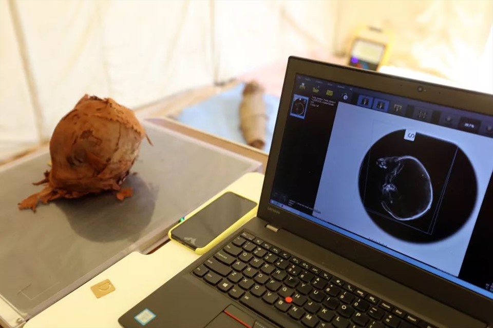 Các nhà nghiên cứu sử dụng máy chụp X quang để phân tích đầu của một đứa trẻ. Ảnh: Đại học Milan