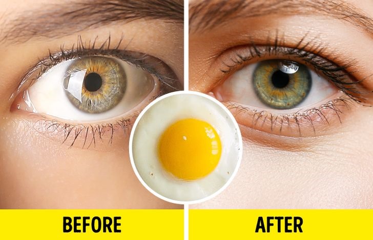 Trứng là thực phẩm chứ nhiều protein. Phần tóc và lông mi được cấu tạo từ keratin. Thực phẩm giàu protein giúp cơ thể có đủ lượng axit amin thích hợp để sản xuất keratin. Đó là lí do trứng sẽ giúp lông mi dài và chắc khỏe hơn.