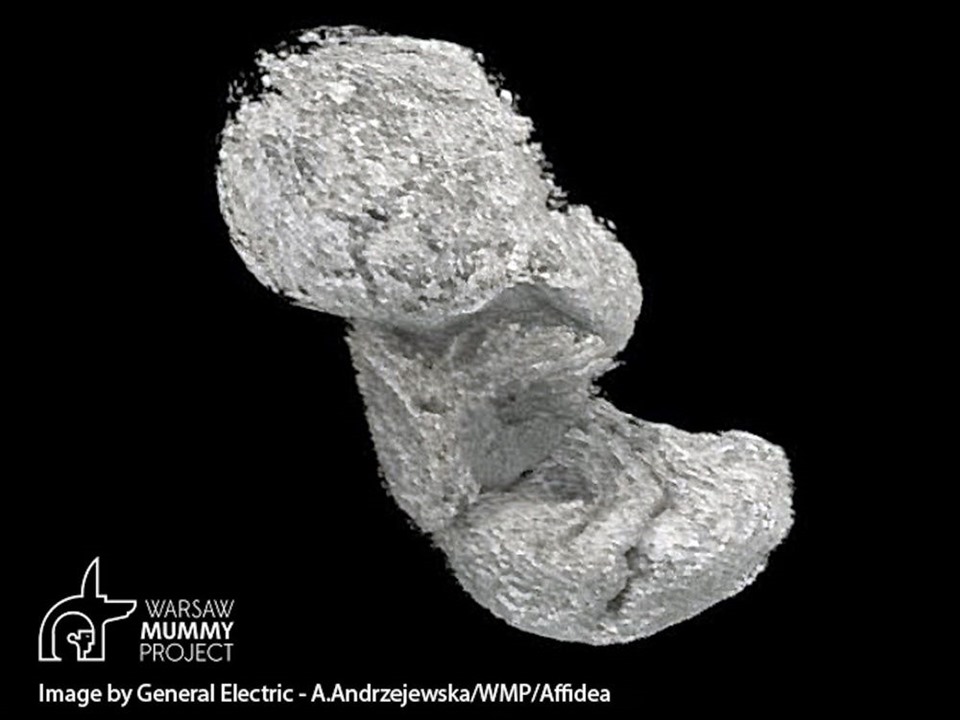 Hình ảnh tái tạo 3D từ quá trình quét xác ướp cho thấy mô mềm được cho là bào thai bên trong xác ướp Ai Cập. Ảnh: Dự án xác ướp Warsaw
