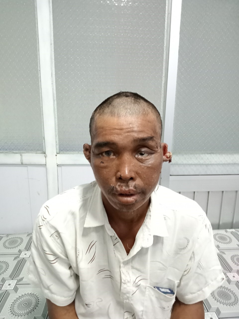Ngư phủ Trương Văn Trung 47 tuổi, ngụ huyện U Minh Thượng, tỉnh Kiên Giang sau khi đã vào bờ được đưa đi giám định thương tật. Ảnh: Công an cung cấp