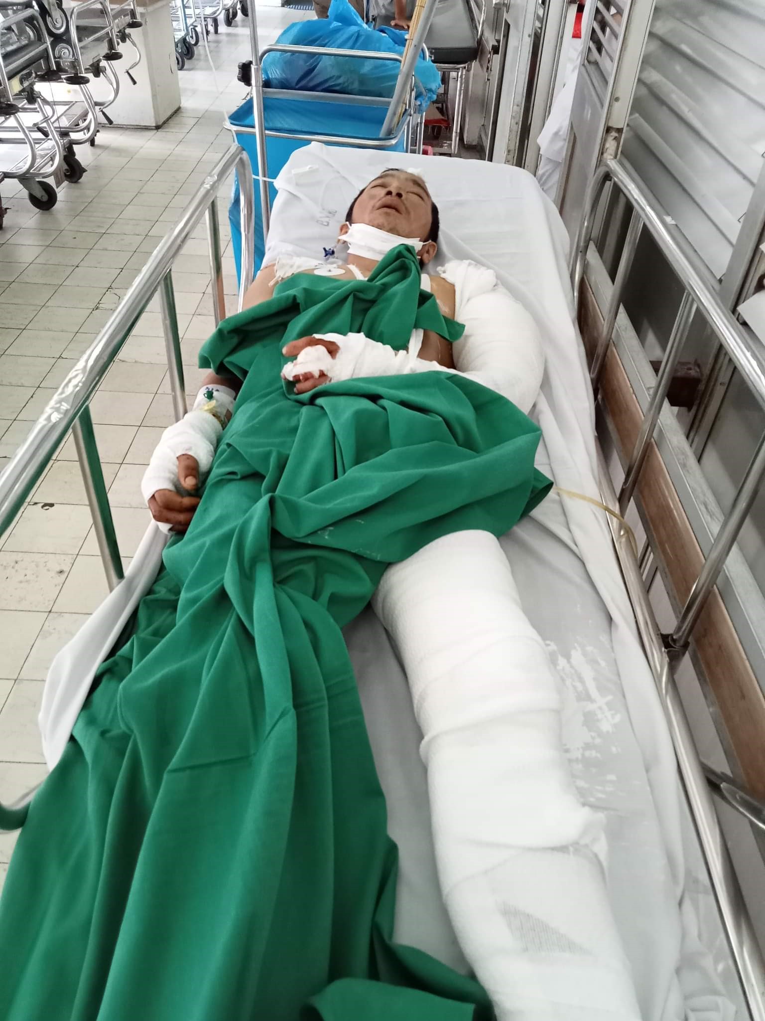 Anh Lô Văn Hà bị chấn thương nặng do tai nạn giao thông. Ảnh: Hải Trung