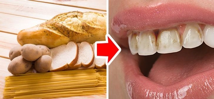 Thức ăn chứa nhiều tinh bột bám vào răng, thậm chí bám lâu ngày trong miệng. Tinh bột kích thích sự hình thành mảng bám trên răng. Bên cạnh đó, tinh bột biến thành đường khi tiếp xúc với nước bọt. Điều này có thể dẫn đến sâu răng và các vấn đề nghiêm trọng khác.