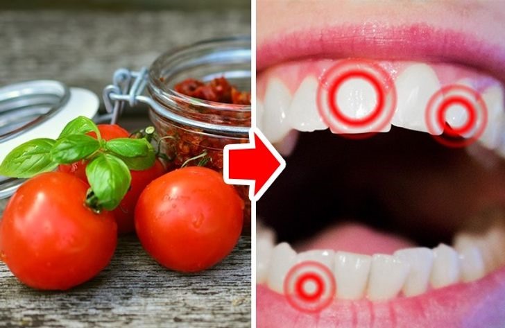 Cũng giống như trái cây họ cam quýt, cà chua là thực phẩm có tính axit. Axit gây hại lớn cho răng, làm tăng độ nhạy cảm của răng. Vì vậy, để giữ được sức khỏe răng miệng, không nên nấu các món ăn từ cà chua quá thường xuyên và quá nhiều.