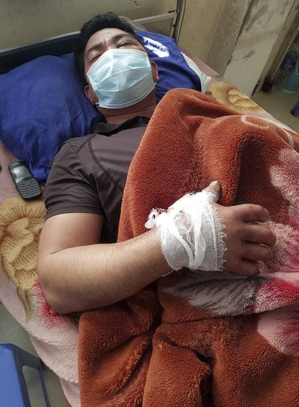 Hình ảnh nạn nhân đang dưỡng thương tại Bệnh viện đa khoa tỉnh Sơn La được con gái nạn nhân chia sẻ.