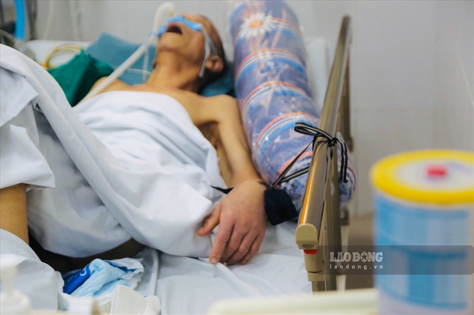 Bệnh nhân này được cố định tay chân để tránh tự tháo các thiết bị hỗ trợ ra khi tỉnh lại.