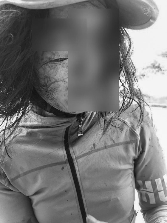 Người phụ nữ tên N.T.N.Y. (22 tuổi, tỉnh Hậu Giang) bất ngờ bị nhóm người tấn công, rạch mặt.