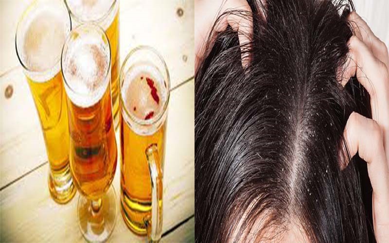 Giúp tóc bớt dầu: Bia giúp cân bằng độ pH trên da đầu và ngăn ngừa tiết dầu quá mức. Nó làm thông thoáng các lỗ chân lông bị tắc. Lấy hai thìa sữa trộn với hai thìa bia và thoa hỗn hợp này lên tóc. Ủ và gội sạch sau 15 phút.