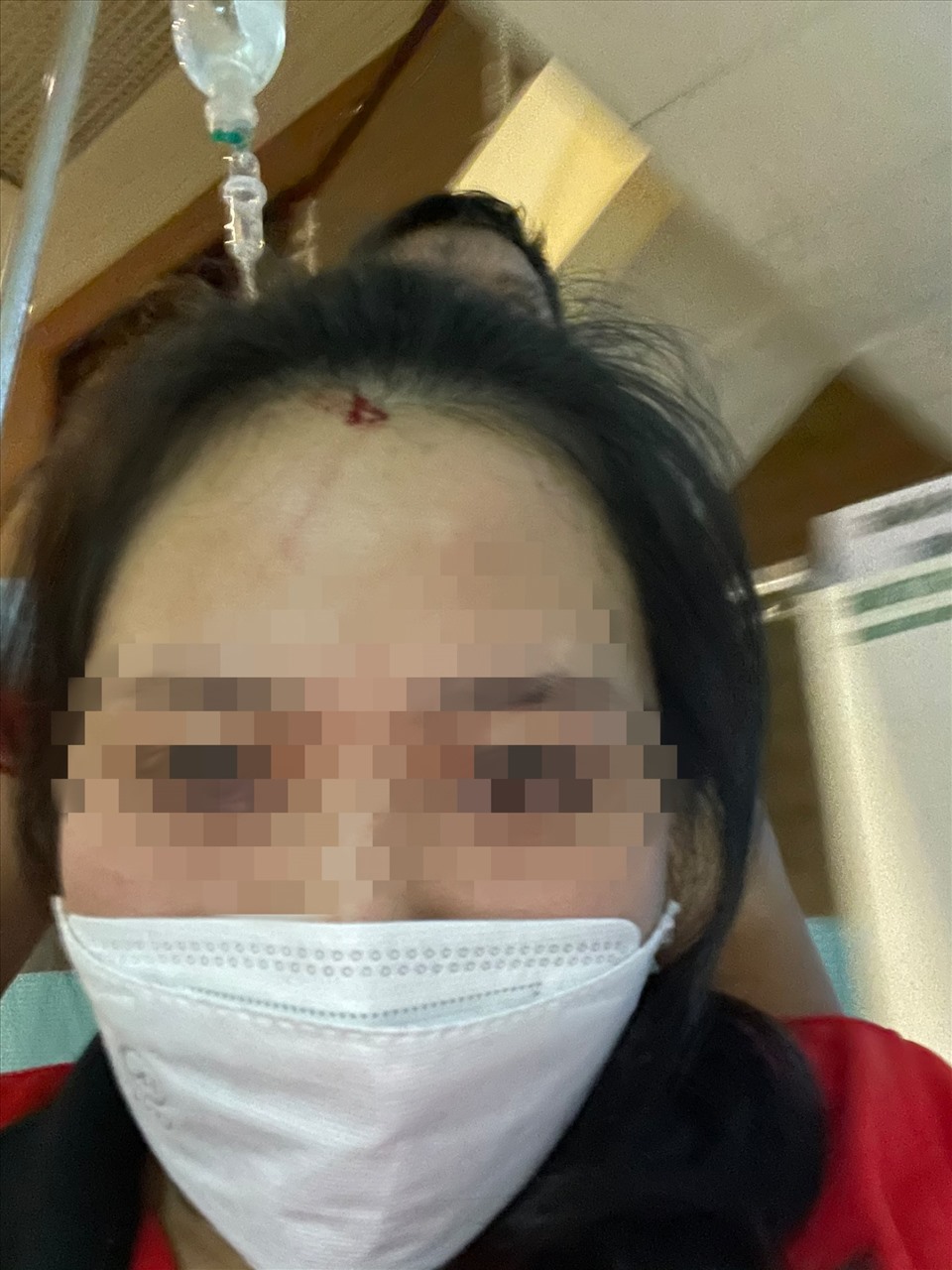 Chị Trang nhập viện sau khi bị đánh.