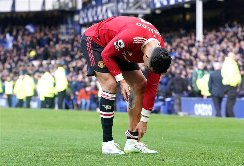 Không còn ai để ý đến vết thương Ronaldo đã gặp phải trong trận đấu với Everton. Ảnh: AFP