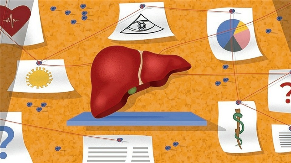 On May 10, the World Health Organization (WHO) said 348 possible cases of hepatitis of unknown etiology had been identified.  The leading hypotheses are still those related to adenovirus.  WHO is studying the potential role of adenovirus and COVID-19 in children with mysterious hepatitis.  Photo: FT