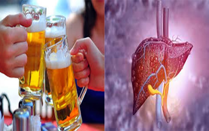 Uống bia rượu: Uống bia rượu thường xuyên sẽ làm giảm khả năng đào thải chất độc ra khỏi cơ thể của gan. Lúc này, gan sẽ phải tập trung chủ yếu vào việc chuyển hóa rượu thành dạng ít độc hơn, từ đó dẫn đến tình trạng viêm nhiễm hoặc gan nhiễm mỡ.