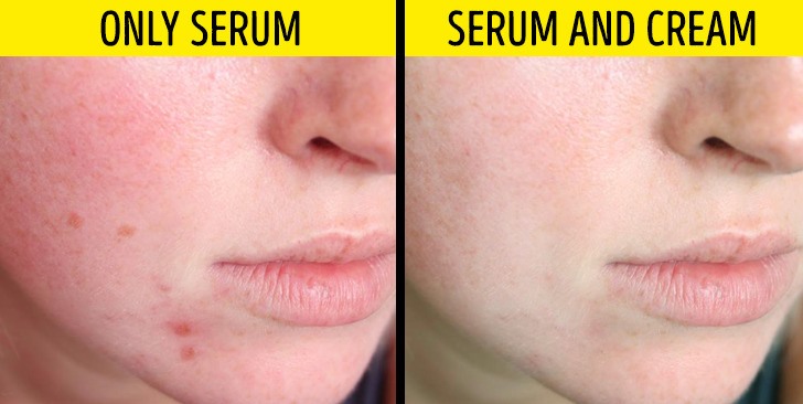 Serum hay còn gọi là huyết thanh, có nhiều tác dụng hiệu quả đối với làn da. Ảnh: Brightside