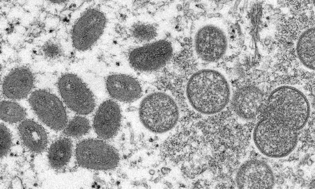 Virus đậu mùa khỉ (hình bầu dục, bên trái) trong một mẫu da người. Ảnh: AP