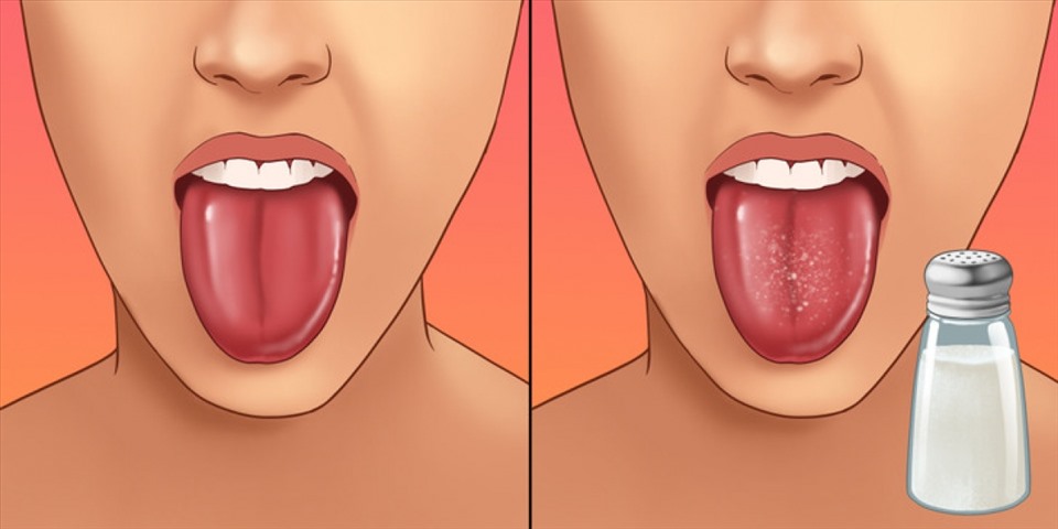Đặt một chút muối vào lưỡi sẽ cải thiện tình trạng mất cân bằng cảm xúc ngay lập tức. Ảnh: Brightside