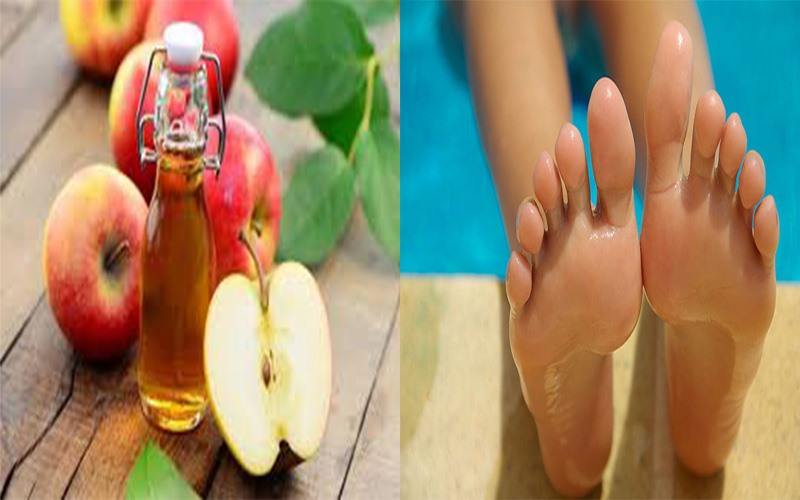 Sử dụng giấm táo: Giấm táo có khả năng cân bằng độ pH trong cơ thể, từ đó giúp giảm lượng mồ hôi tiết ra. Giấm táo giúp kiểm soát mồ hôi bằng cách làm cho lỗ chân lông se khít. Trộn 1 thìa cà phê giấm táo và 1 thìa nước hoa hồng. Thấm hỗn hợp lên trên lòng bàn chân của bạn.