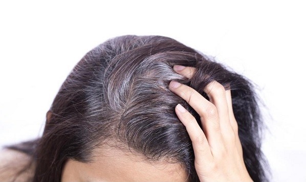 Giải pháp và cách điều trị rụng tóc ở nữ giới