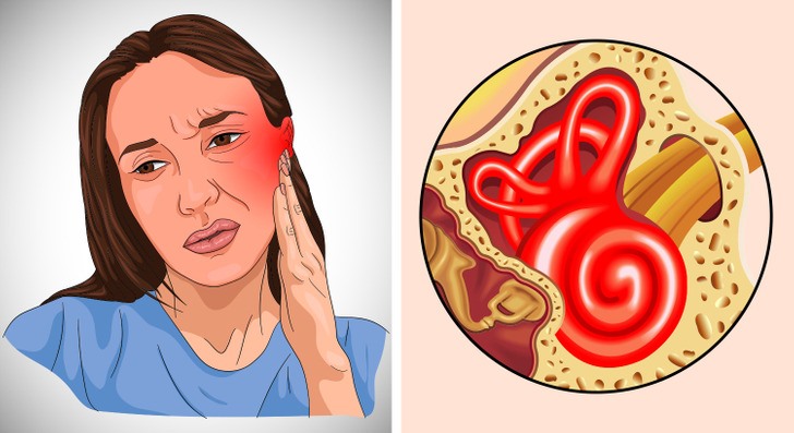 2. Đỏ ở bên trong và bên ngoài tai: Nhiễm trùng tai cũng có thể bắt đầu với một số mẩn đỏ nhẹ trên ống tai trong. Tuy nhiên, nếu việc nhiễm trùng nặng hơn, mẩn đỏ sẽ dễ nhận thấy hơn không chỉ ở bên trong mà còn ở bên ngoài tai. (Ảnh: Brightside)