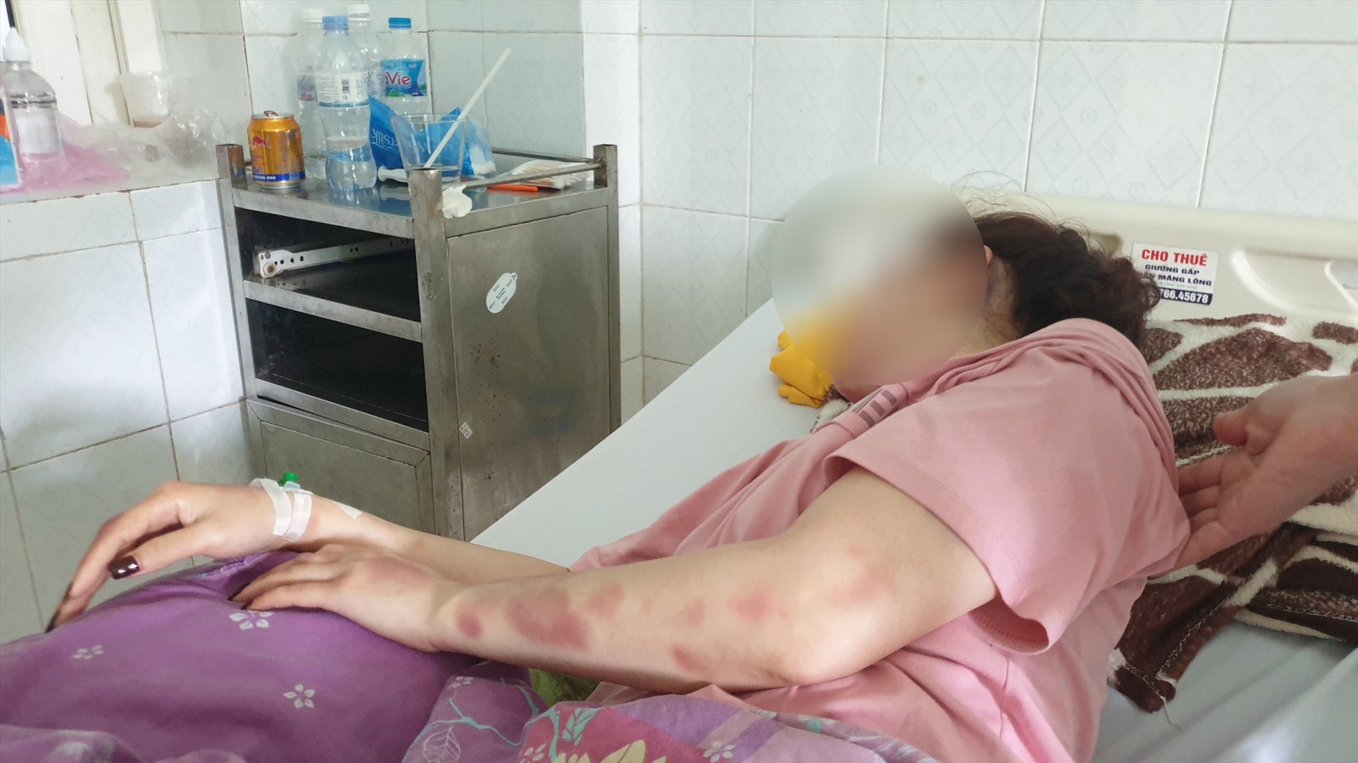 Sau khi bị đánh, chị N.T.V. phải nhập viện điều trị ở Bệnh viên Đa khoa tỉnh Thanh Hóa. Ảnh: Q.D