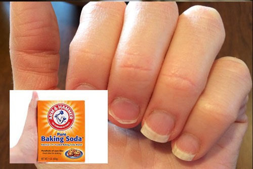 Mẹo hay từ baking soda có thể trị nấm móng tay, chân. Ảnh đồ họa: Hàn Lâm