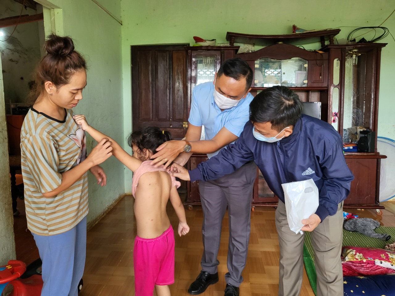 Một trường hợp trẻ em bị bệnh thủy đậu ở xã Ea Kao. Ảnh: Mai Lê