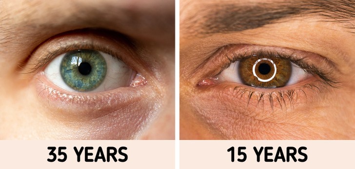 Đôi mắt có thể nói lên tuổi thọ của bạn. Ảnh: BrightSide