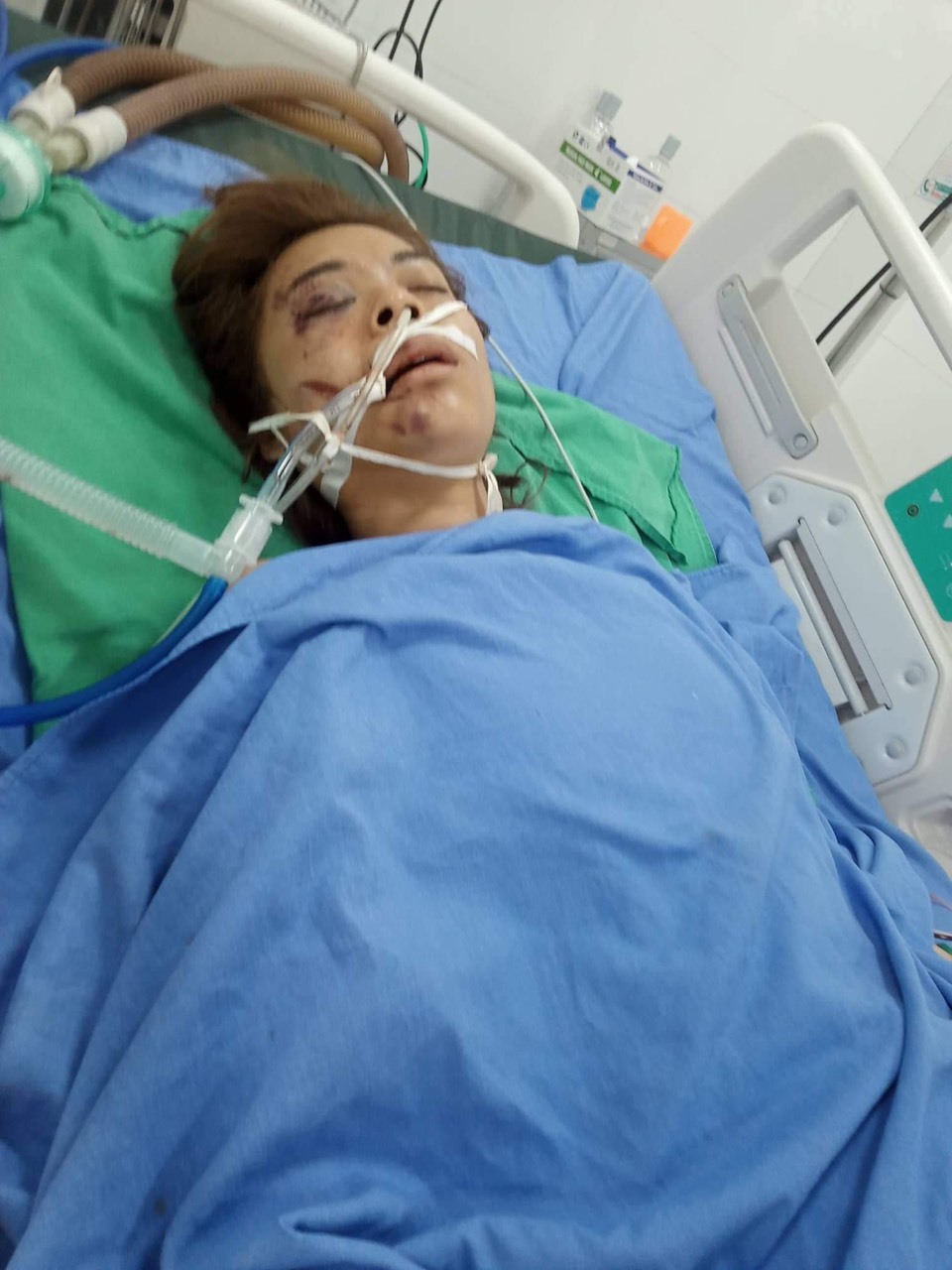 Chị Lò Thị Nhân - vợ thầy Khay hiện đang điều trị tại Bệnh viện Đa khoa tỉnh Sơn La. Ảnh: Gia đình cung cấp