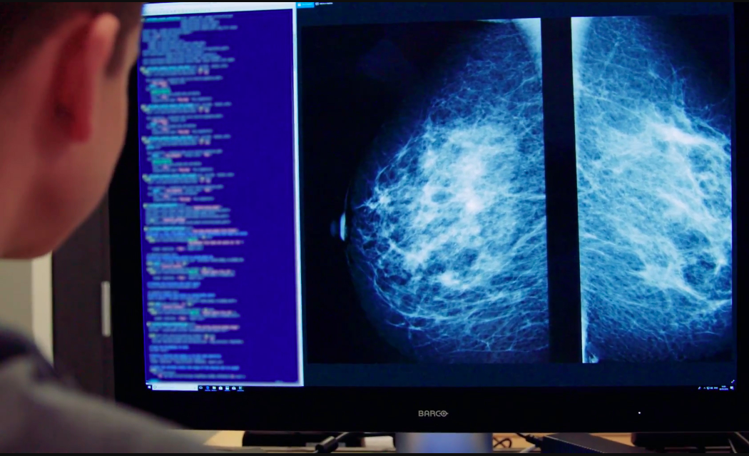 Trí tuệ nhân tạo giúp chẩn đoán ung thư vú chính xác và dễ dàng hơn. Ảnh: Kheiron Medical Technologies