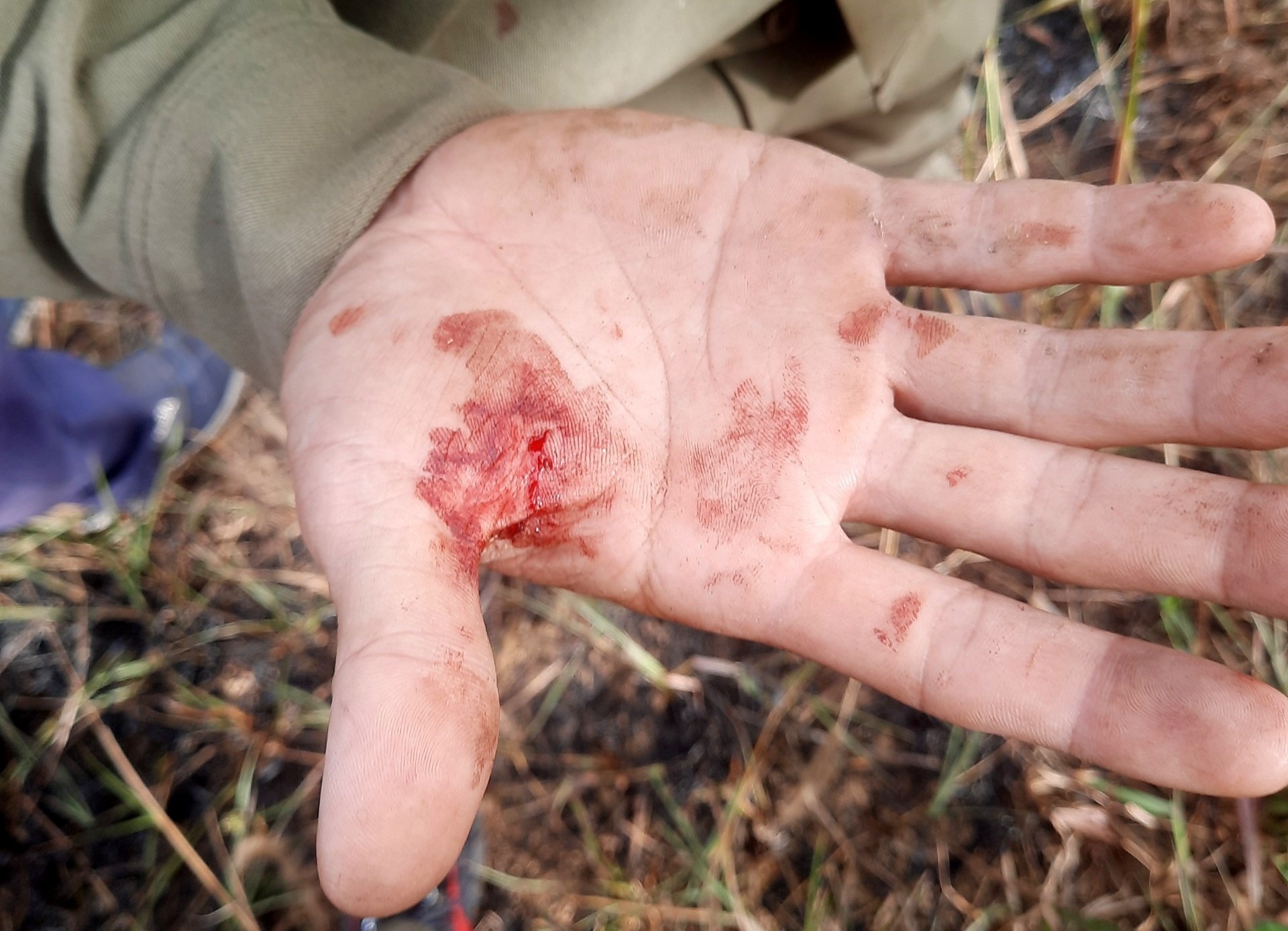 Sau khi té ngã, nhân viên Quản lý bảo vệ rừng đã bị đinh đâm trúng tay. Ảnh: Gia Bảo