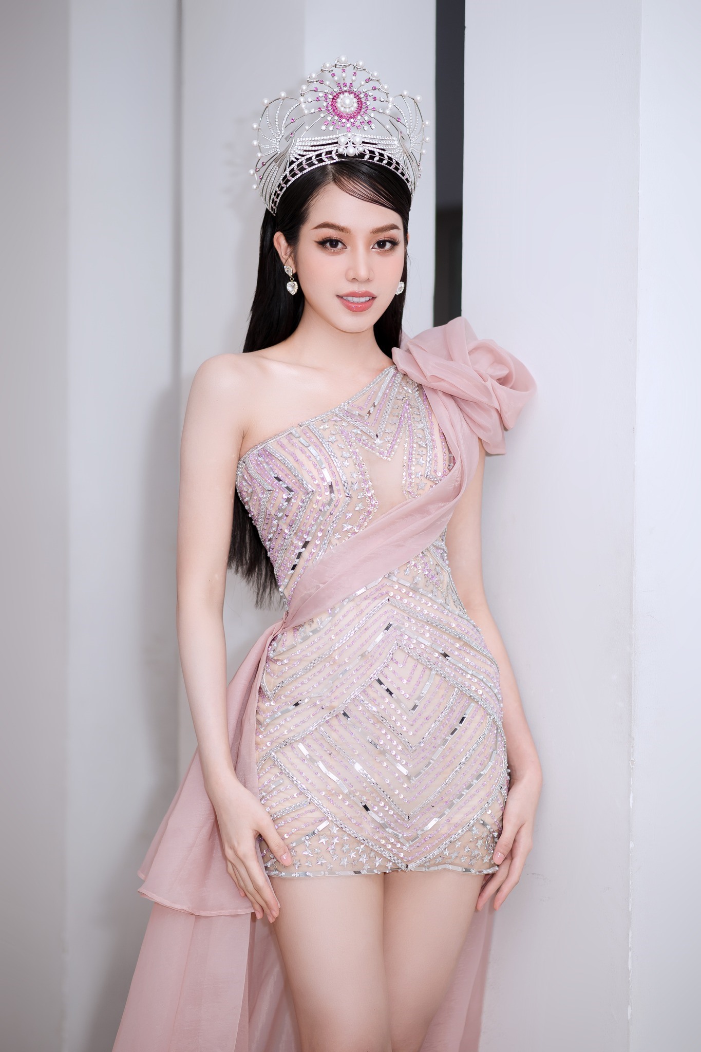 Vẻ đẹp của Hoa hậu Việt Nam sau phẫu thuật thẩm mĩ. Ảnh: Nhân vật cung cấp
