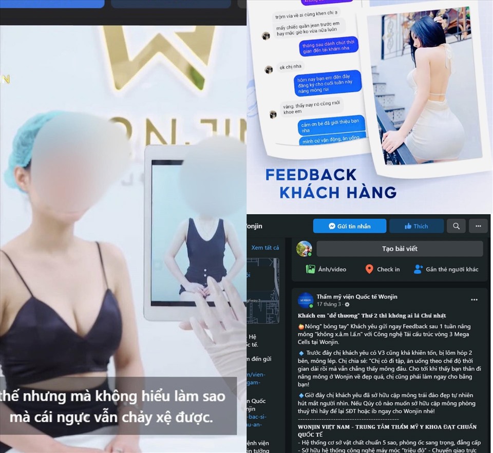 Hình ảnh, video, bài viết quảng cáo nâng ngực, nâng mông được đăng tải, xuất hiện với tần suất dày đặc trên nền tảng mạng xã hội facebook của cơ sở thẩm mỹ trái phép Wonjin. Ảnh: Phóng viên chụp màn hình
