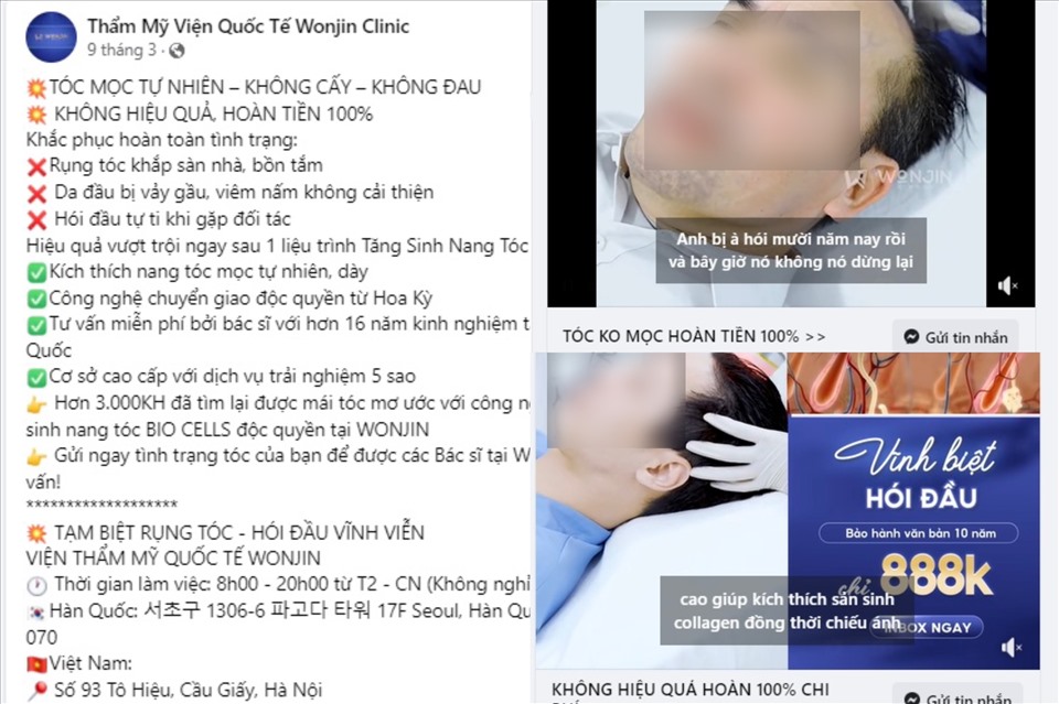 Hình ảnh, video, bài viết quảng cáo trị hói đầu được đăng tải, xuất hiện với tần suất dày đặc trên nền tảng mạng xã hội Facebook của cơ sở thẩm mỹ trái phép Wonjin. Ảnh: Phóng viên chụp màn hình